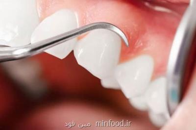 روشهای زیبایی و ترمیم دندان