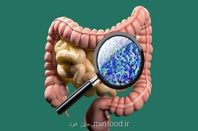 تاثیر رژیم غذایی پرچرب همراه با آنتی بیوتیك در بروز التهاب روده