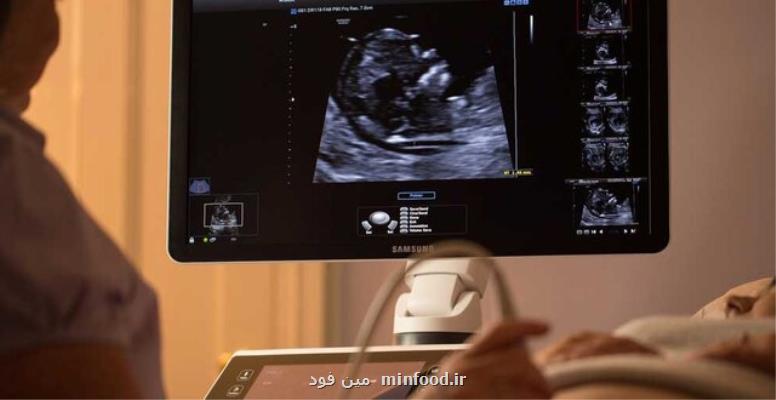 شرط و شروط درمان بیماری های زنان در كرونا از علایم غیرطبیعی، ساده گذر نكنید